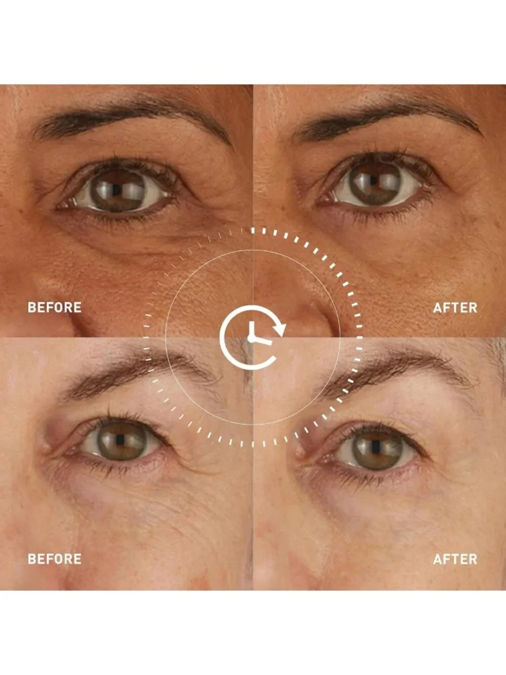 Hydrating Firming Eye Patches with Peptides & Coenzyme Q10 for Dark Circles